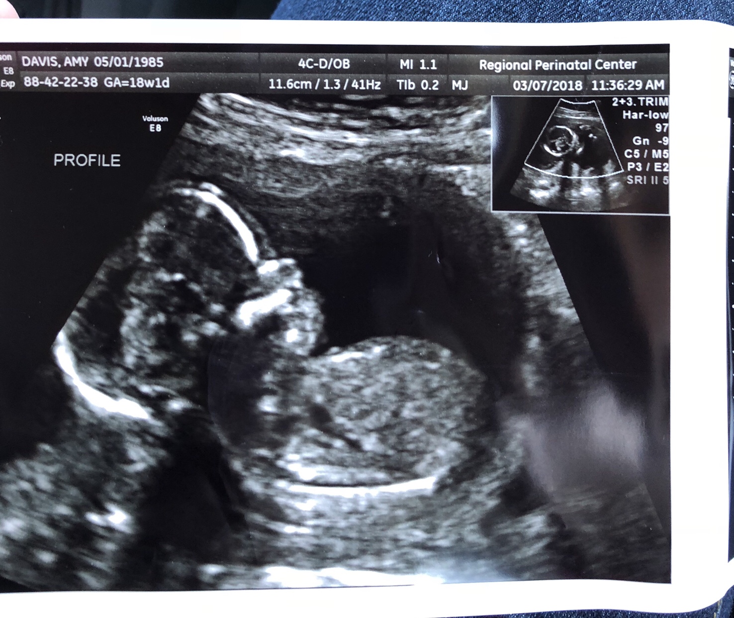 My tiny little miracle, Isaac. 