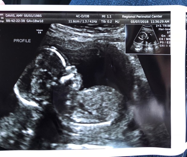 My tiny little miracle, Isaac. 